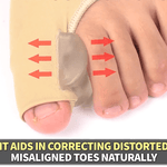 Orthopedic Bunion Pain Relief & Correction Sleeve (1 Pair) - HalluxCare™
