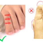 Orthopedic Bunion Pain Relief & Correction Sleeve (1 Pair) - HalluxCare™