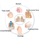Orthopedic Bunion Pain Relief & Correction Sleeve (1 Pair) - HalluxCare™