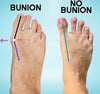 how to find comfortable shoes for wide feet with bunions