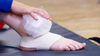 Using a Cold Compress for Bunions