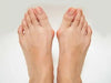 How to decide if bunion surgery is necessary and what to expect from the procedure