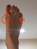 How long does it take for a bunion to become big?