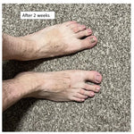 Orthopedic silicone gel hammertoe corrector toe straightener - product packaging