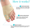 Orthopedic Bunion Pain Relief & Correction Sleeve (1 Pair) - HalluxCare - Made in Oregon